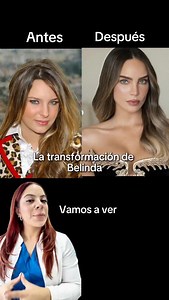 Versión Icon ✨ De niña dulce a referente de estilo, evolución con intención, timing y mucha actitud. Rasgos suaves a ángulos protagonistas, una transición que se nota sin perder su esencia. Comenta tu highlight favorito y envíalo a quien ame los glow up. 💬 _______________________________________ Responsable sanitario:Renata Viridiana Perez Medicina 12455600 UVM Permiso de publicidad: 253301201A1226 | Belleza Latina Clinic
