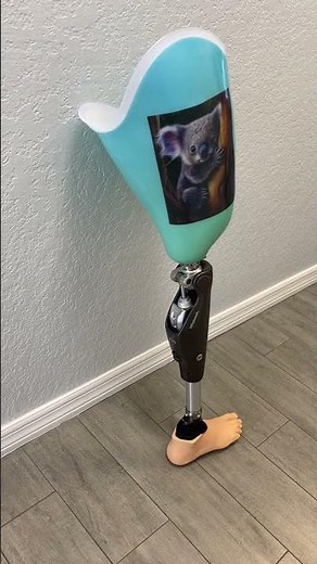 Check out this AK prosthesis featuring the Otto Bock C-Leg 4 microprocessor-controlled knee and a Ki