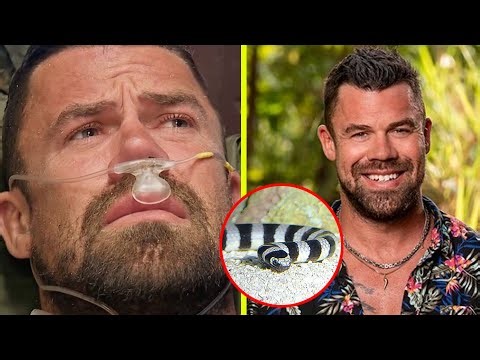 Survivor 49 Star Jake Latimer BITTEN by a Snake – His Jaw Dropping Recovery!