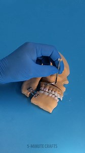 1.8M views · 2.7K reactions | The way of fixing jaw 醴 | 5-Minute Crafts Family | Facebook