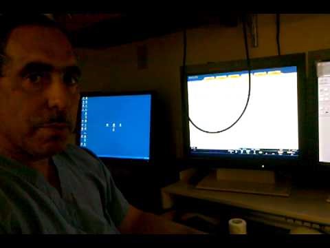 Dr. John Lasala Describes the Impella 5.0