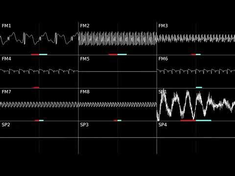 Sonic 3 Final Boss (Big Arms) - Renditioned v3 ‪@MCSgame-1508‬ Corrscope