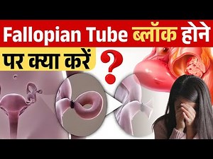 fallopian tube ब्लॉक होने पर क्या करे ?😱 Blocked Fallopian tube & fertility tips | Fertility Guide