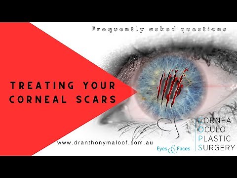 FAQ - Treating your corneal scars with Dr Anthony Maloof, Sydney