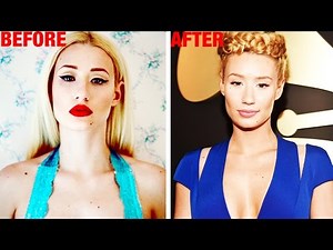 Iggy Azalea "Improves" Her Body??
