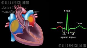 78K views · 1.1K reactions | Cardiac Conduction System And Understanding ECG | Meddy Bear | Facebook