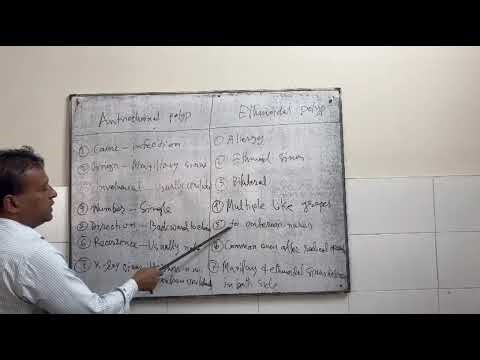 Difference between antrochoinal polyp and ethmoidal polyp.