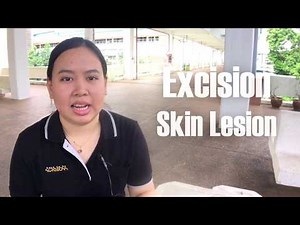 Excision Skin Lesion Tutorial