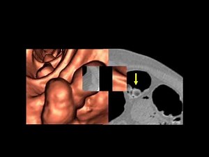 UCSF Radiology: Interpreting The Images