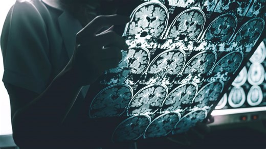 Check Your Region: New Study Maps America's Dementia Danger Zones