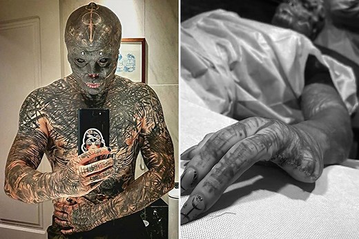 French ‘black alien’ reportedly gets fingers sliced off to create claw