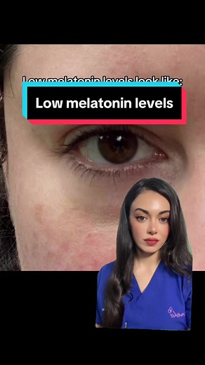 Effects of Low Melatonin Levels on Skin Health
