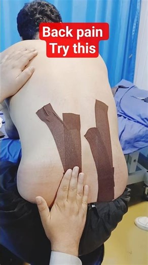 🔥 Instant Relief from Back Spasm💪 Must Try Technique#shorts#trending #painrelief #tapping #rehabtech