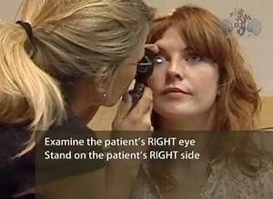 ophthalmoscopy video - 直接检眼镜|眼底检查