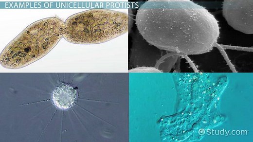Protist Definition, Names & Examples