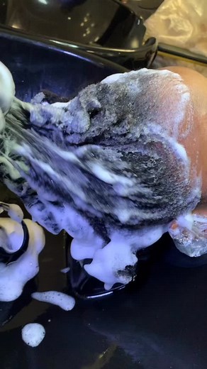 Dandruff is a common scalp condition that leads to the appearance of...