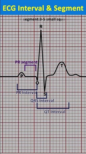 ECG basic I Ecg interval and segment #shorts