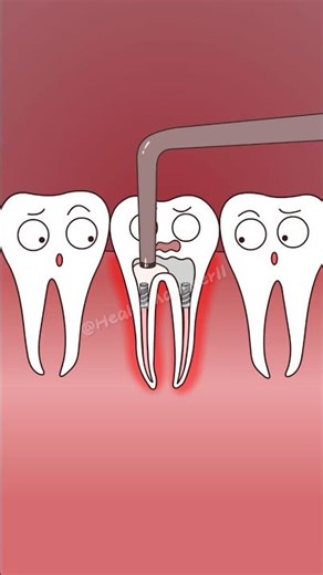 How does a dentist treat your teeth step by step?#shorts