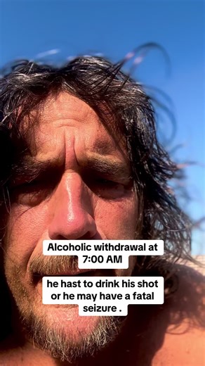 Cuidado con la cirrosis alcohólica: Salud de las uñas