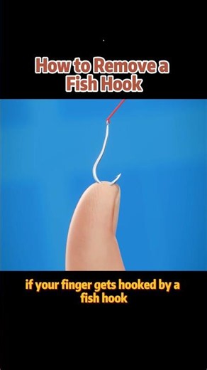 How to remove a fish hook.#youtube #knowledge #nature #science #dailyroutine