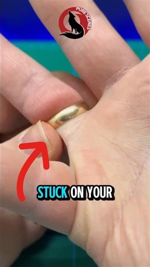 Remove ring stuck your finger trick #diy