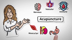 Acupuncture