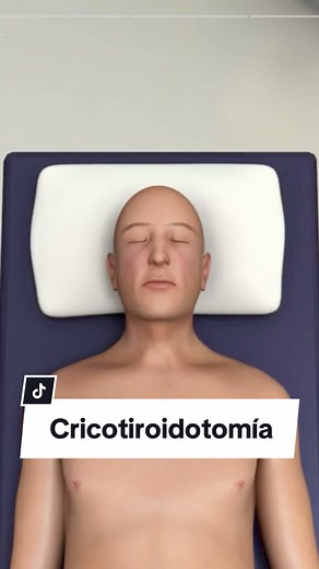Cricotiroidotomía Surgery: Understanding the Procedure