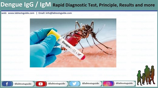 Dengue IgG / IgM Rapid Diagnostic Test | Lab Tests Guide