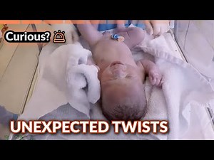 Neonatal Challenges Explored | 24 Hour Baby Hospital