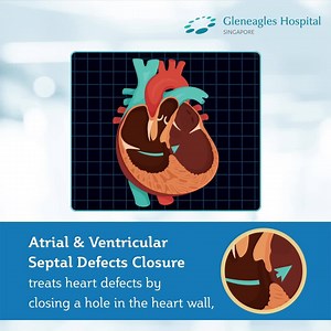 33 reactions | No more long, unsightly scars. Just minimal pain and quicker recovery. Minimally invasive cardiac surgery (MICS) has been used for coronary artery bypass surgery (CABG) and cardiac valvular surgery in reducing pain and suffering for heart patients. Find out how the procedure works: bit.ly/31SpwMm Drop us a message on Facebook to enquire more: bit.ly/2VkPfuw | IHH Healthcare Singapore - Indonesia Office | Facebook