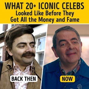 What 20 Iconic Celebs Looked Like Before They Got All the Money and Fame | Bright Side
