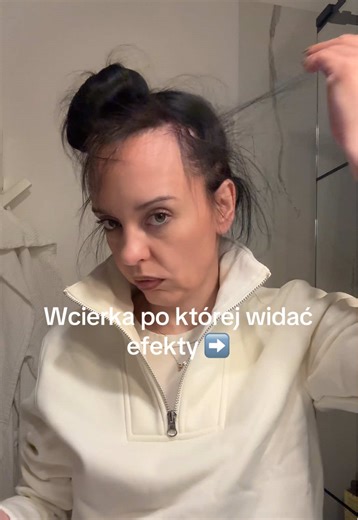 Najlepsza wcierka na porost włosów (u mnie się sprawdziła) ♥️♥️♥️ #wcierka #hair #longhair #babyhairs