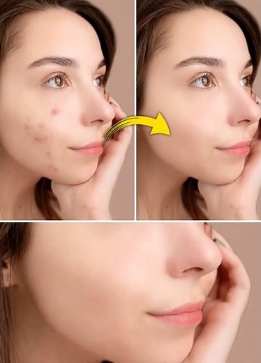 Photoshop Skin Retouch Tutorial for Beginners