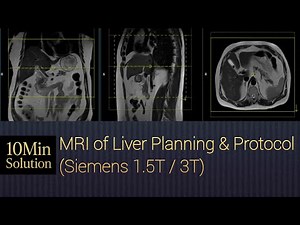 MRI of Liver Planning Step by Step | Siemens 1.5T & 3T Protocol