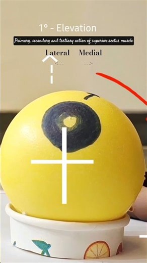 Actions of EOM - SR (Rough eye model)| Watch full video to learn more #optometry