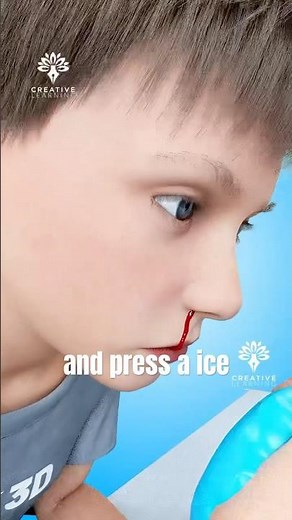What To Do If You Get A Sudden Nosebleeds #shorts - creativelearning3d
