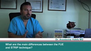Hair Transplant Methods: What Is the FUE Technique the Best?