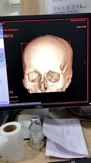 Ct brain #youtubeshorts #viralvedios #shortfeed #medicalimaging #medicaltest #shortvideo #baby