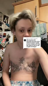 189K views · 1.5K reactions | Questions about mastectomy recovery after breast cancer surgery. #mastectomy #breastcancerawareness #Cancer #cancerawareness #cancersurvivor #BreastCancer #doublemastectomy #breastcancersurvivor #dont4get2check | Kitty MorningStar | Facebook