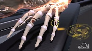 15K views · 287 reactions | Heal - The medical animation of extreme...