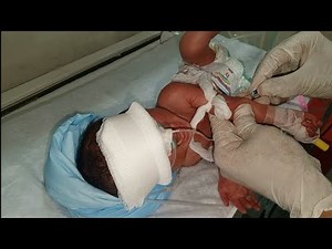 How to Take Blood Sample in Newborn Baby | Step by Step NICU Procedure |