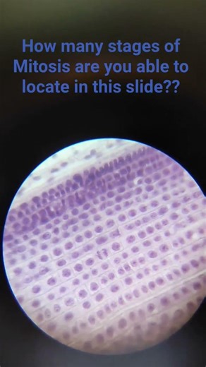 Stages of Mitosis under the microscope in onion root tip.#mitosis #biology #practical#12th#fyp#pcb