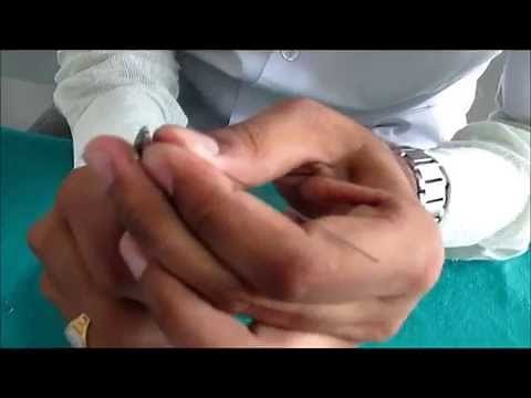 How to make a Finger spring - Orthodontics