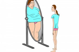 What is anorexia nervosa? Symptoms and treatment