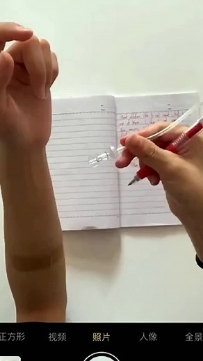 Documenting a Medical Procedure with Handwritten Notes