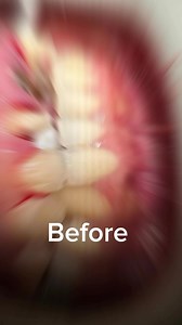 7.8K views · 43 reactions | Before and after  | Cabinet Dr Sabrine Khalifa Mansour | Facebook