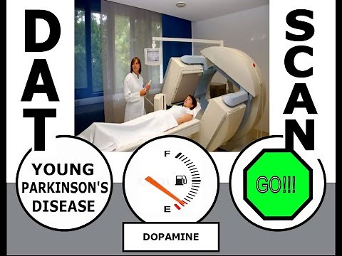 DATScan News Clip - DATScan reveals an Early Parkinson Diagnosis #DATScan #YoungParkinsons