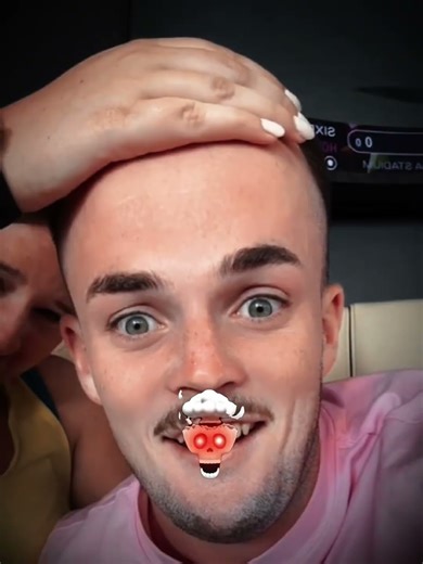 Biggest forehead trend part.-3 😖😆 #trollface #edit #troll #fyp