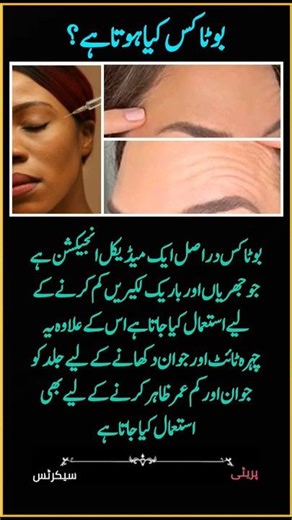 "Turn back time with just one injection – Botox glow! 🌟 #YouthfulSkin"