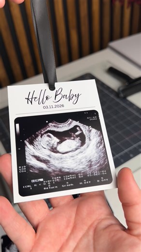 Zlatelina / Magnetic Soul | Introducing our new ultrasound model magnets — designed not only for exceptional imaging performance but also with versatility in mind.... | Instagram